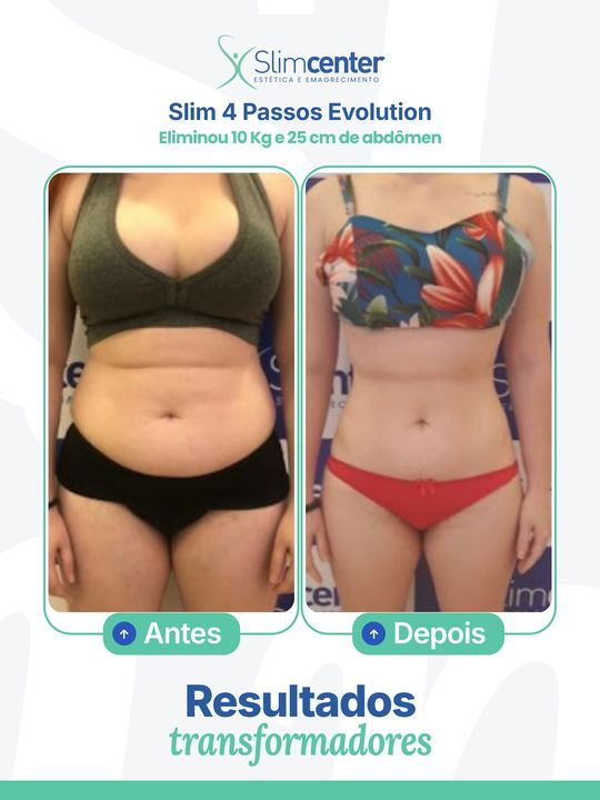 Antes e depois de Slim 4 Passos Evolution