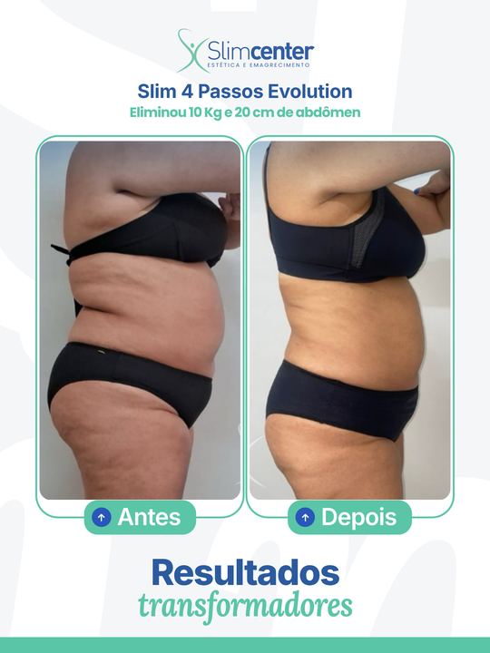 Antes e depois de Slim 4 Passos Evolution