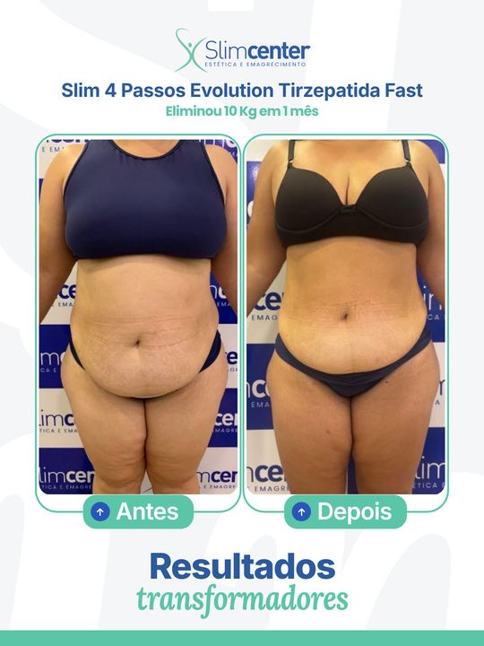Antes e depois de Slim 4 Passos Evolution